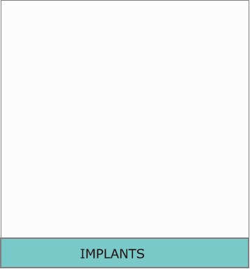 IMPLANTS